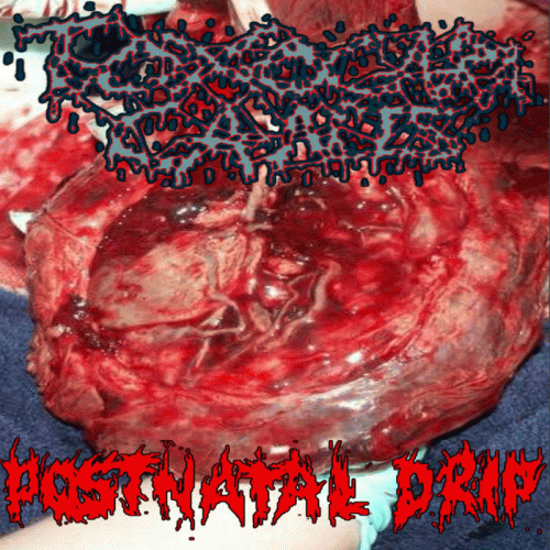 Toxocara Canis : Post Natal Drip